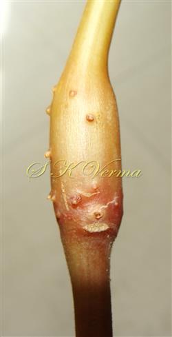  Swollen node